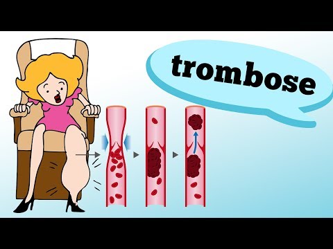 WHAT ARE THE SYMPTOMS AND CAUSES OF THROMBOSIS?