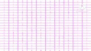 Budgett’s frog screaming but it speeds up to infinity (part 2)