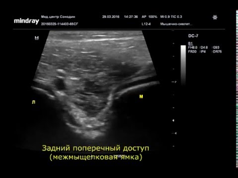 Неумывакин о лечении позвоночника и суставов Поясница лечение баней