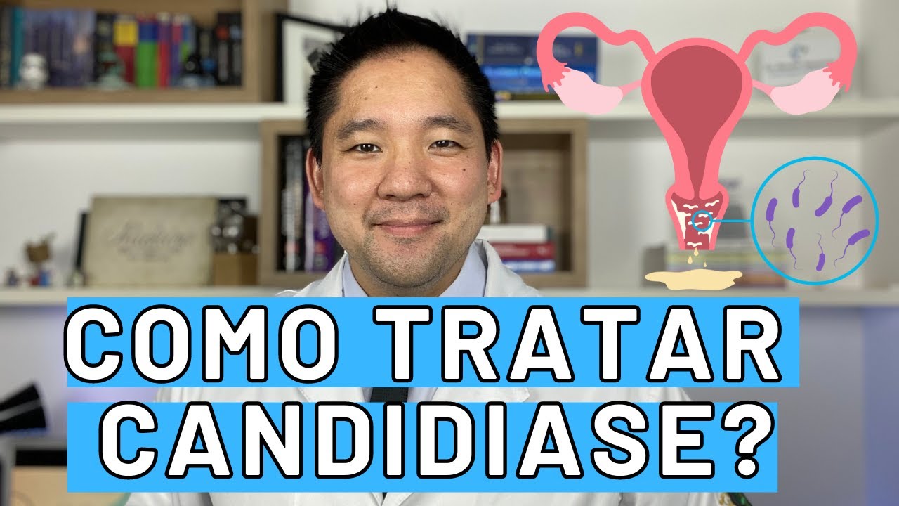 COMO TRATAR CANDIDIASE VAGINAL, A PRINCIPAL CAUSA DE COCEIRA NA MULHER