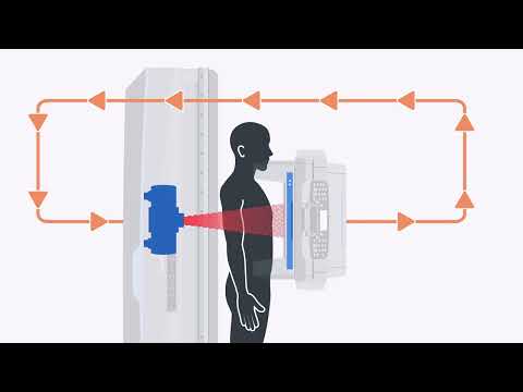 Easy as ABC - Automatic Brightness Control: Fluoroscopy systems and components