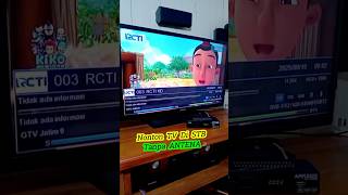 Download lagu How to Watch TV on a Set Top Box Without an Antenna mp3