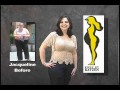 Body Contouring By Beverly Hills Plastic Surgeon Dr Timothy Katzen Los Angeles Commercial