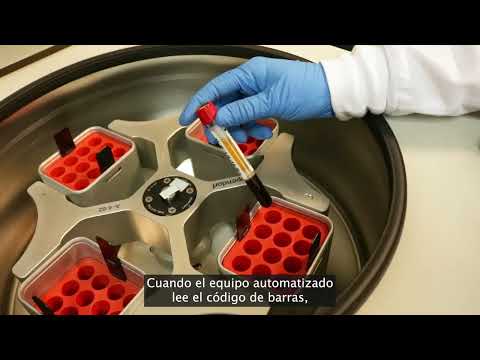 Procesamiento de muestra en laboratorio clínico