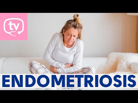 Qué es la endometriosis y tipos