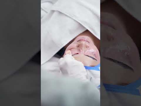 Transform your skin with our Medicated Photo Facial. Radiate confidence and embrace your beauty!