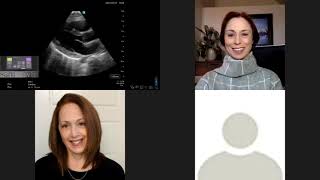 Assisted Cardiac Output with Sonosite PX: Streamline Your Fluid Responsiveness Evaluations