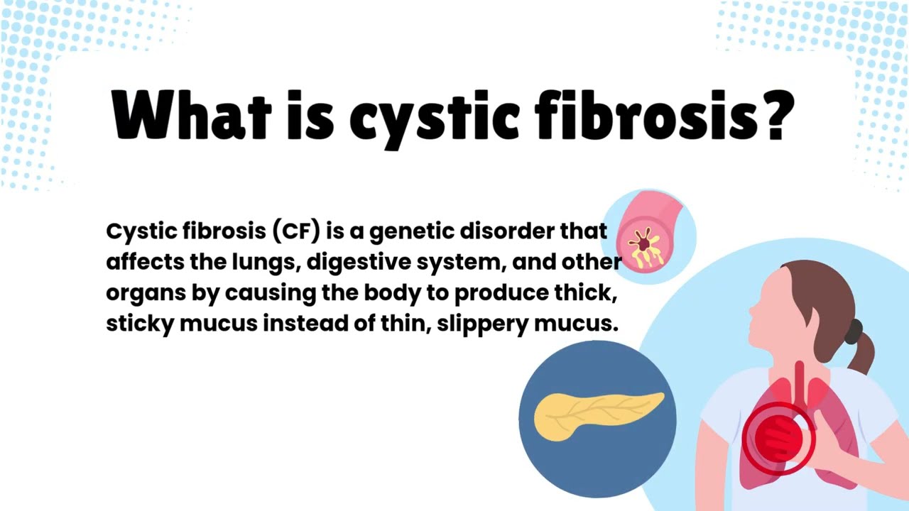 Cystic Fibrosis