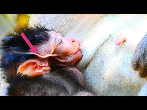 OMG What is This?,Vessel or Skin appear On Face Baby Jayden,Pity Baby Suck Milk Till Sleep Like..