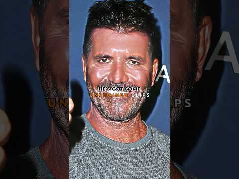 What Happened to Simon Cowell's Face??