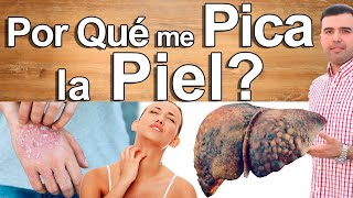 Porqué Me Pica La Piel de Noche o de Dia - Causas y Soluciones de La Picazón de Piel