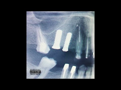 Nessyou - Abcès (Full EP)