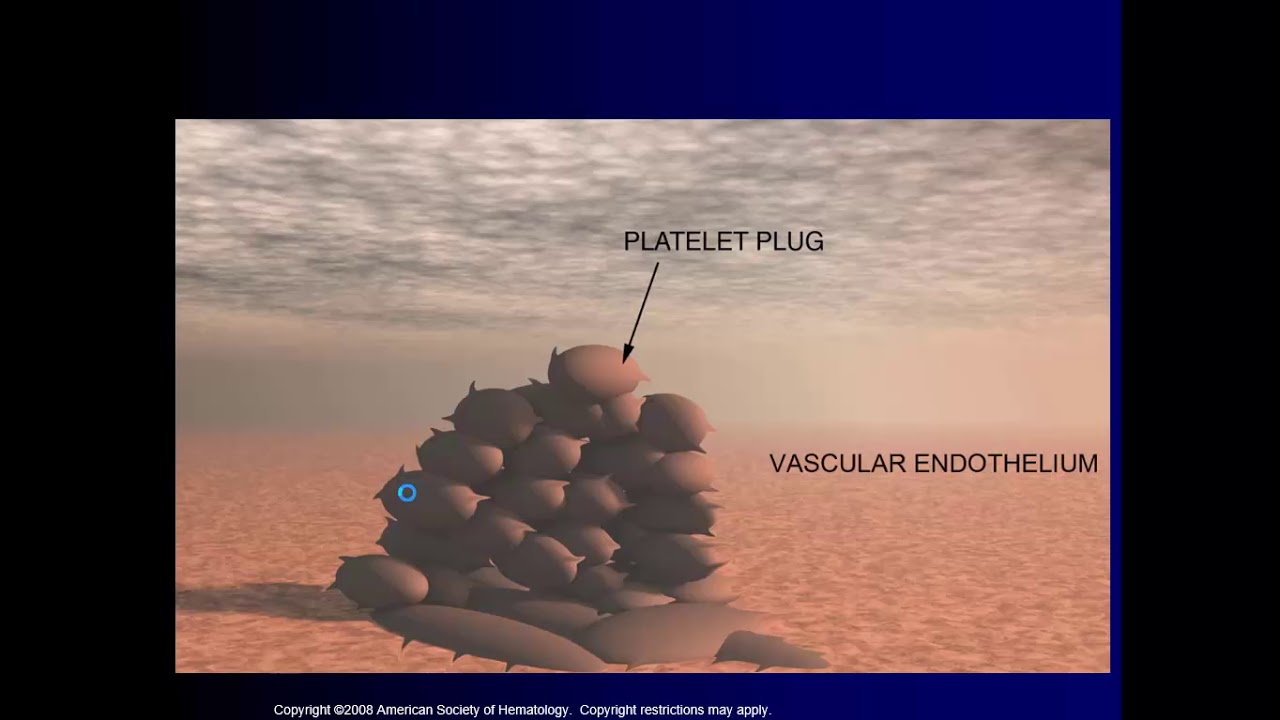 Clase 57 Trastornos hemorragicos