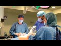Técnica de manga gástrica por laparoscopia realizada por el Dr. Rey Romero en cirugía para la obesidad y diabetes en Veracruz, México