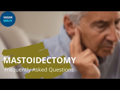 Mastoidectomy- Frequently Asked Questions