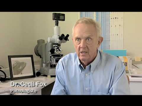 Les origines du Sida (la meilleure qualité disponible)