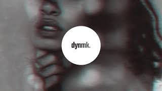 Mickey Shiloh - Better In My Head