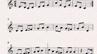 Hist, Hvor Vejen Slar En Bugt