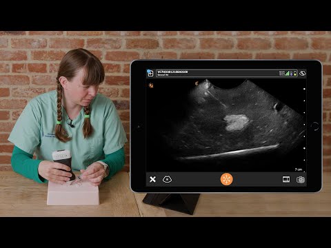 Ultrasound Guided Fine Needle Aspirate