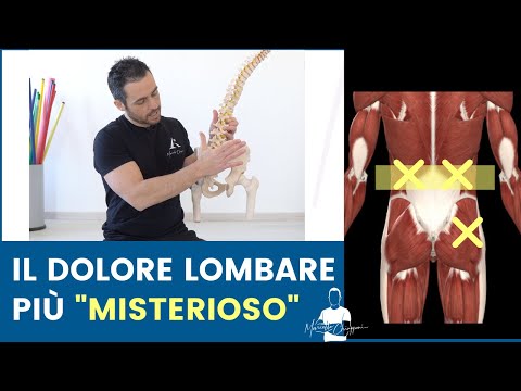 Ecco il DOLORE LOMBARE meno "capito" di tutti (e come risolverlo)