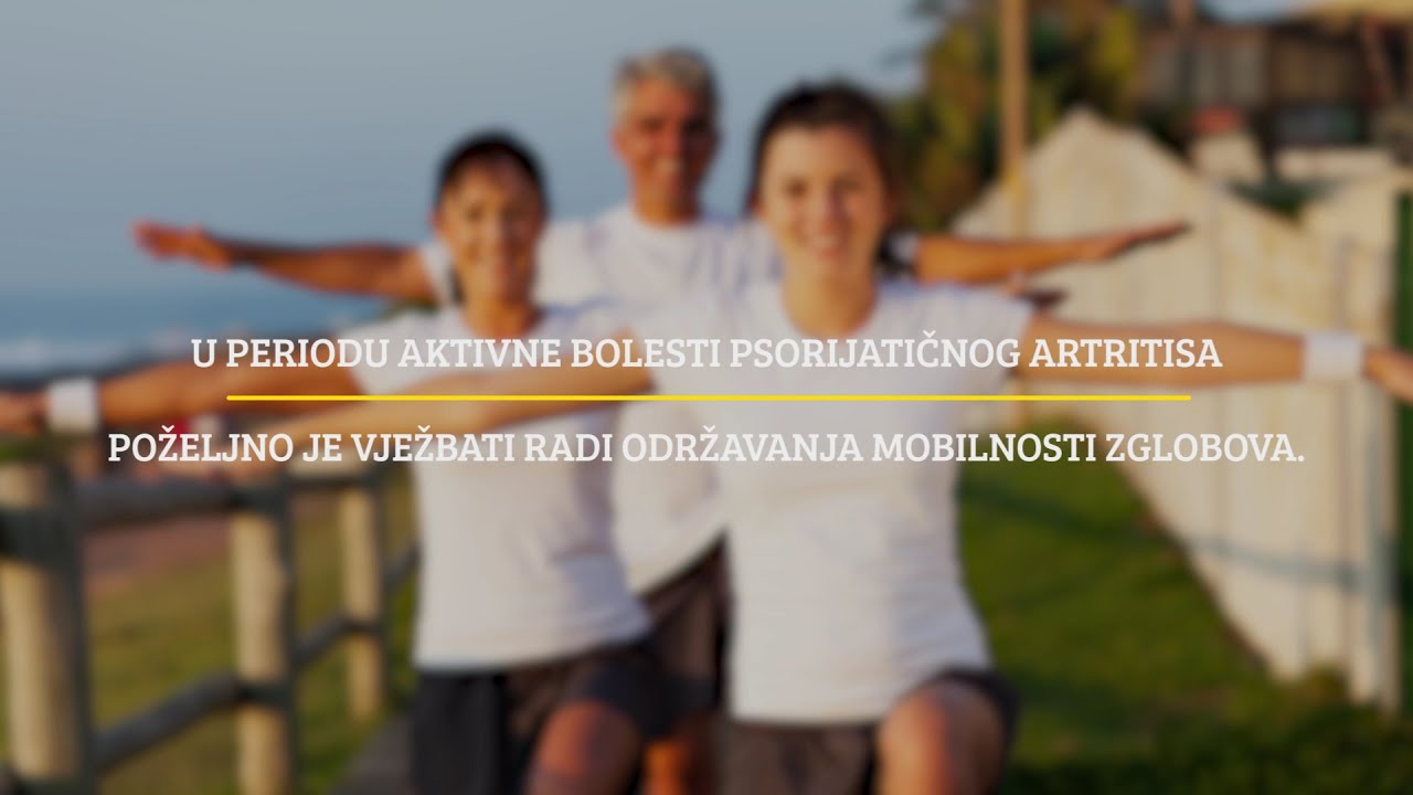 Vježbe mobilnosti i jačanja za oboljele od psorijatičnog artritisa