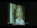 Naturally Plus Skin Disorder Ichthyosis Testimony