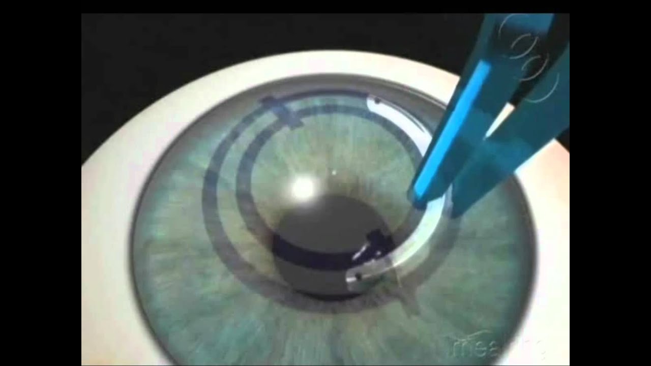 Fernando Hernández Miranda-3