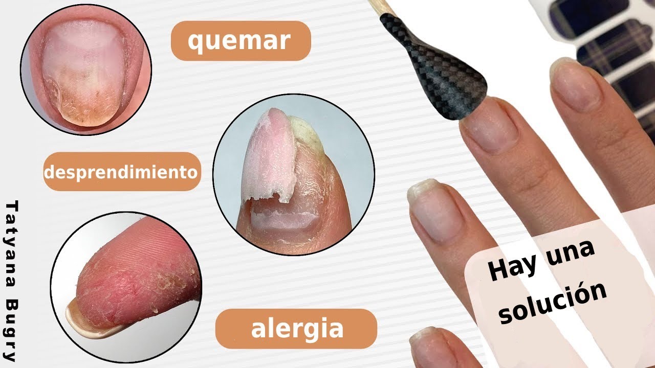 Watch Desprendimiento de uñas Alergia Quemar 🛑 Hay una solución ☝ #TatianaMaestradeUñas Now Desprendimiento de uñas Alergia Quemar 🛑 Hay una solución ☝ #TatianaMaestradeUñas