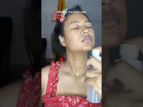 Achieve Glass Skin with Daily Rice Water Spray for Festive Glow “মা আসছে-series“ #ricewaterbenefits