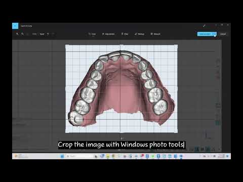 How to customize archform