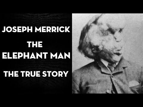 Joseph Merrick (The Elephant Man) The true story