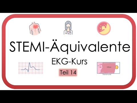 STEMI equivalents (De Winter, Sgarbossa, Wellens sign, suffocation T, ST depressions)