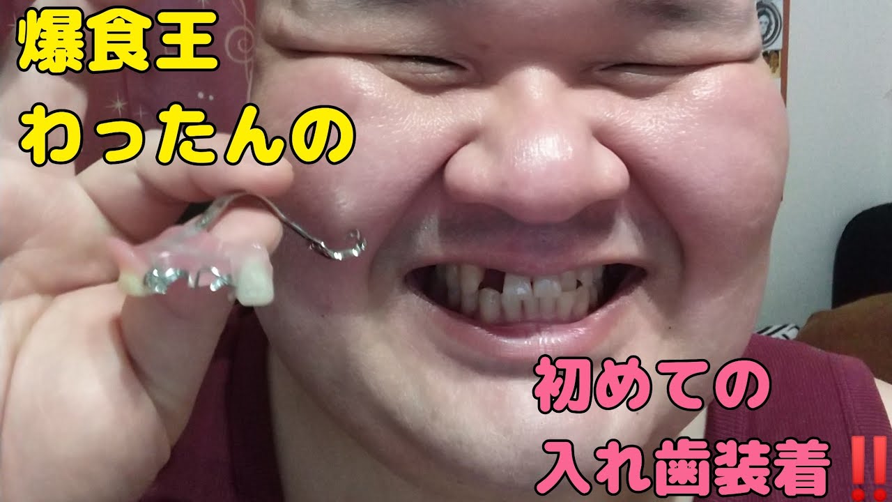 【✨感謝✨】爆食王わったんの初めての入れ歯装着‼️