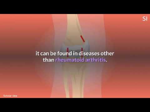 Boli inflamatorii ale articulațiilor artroza reumatoidă