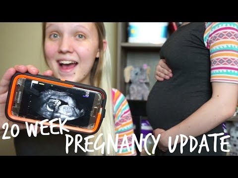 Week 20 Pregnancy Update│WE HAD OUR ANATOMY ULTRASOUND! Video
