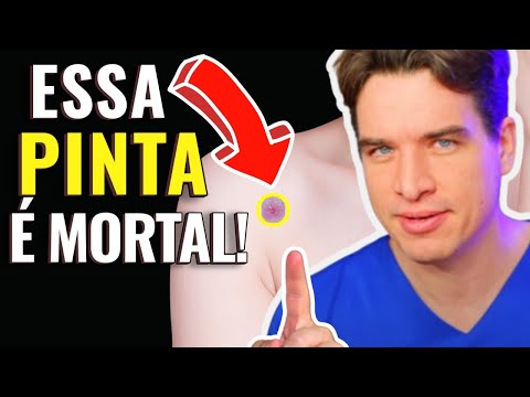 MOLE or MELANOMA? KNOWING THE DIFFERENCE CAN SAVE YOUR LIFE!