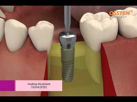 Dental Plaza