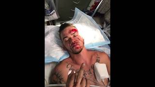 MY WORST CRASH EVER (EXPLAINED)