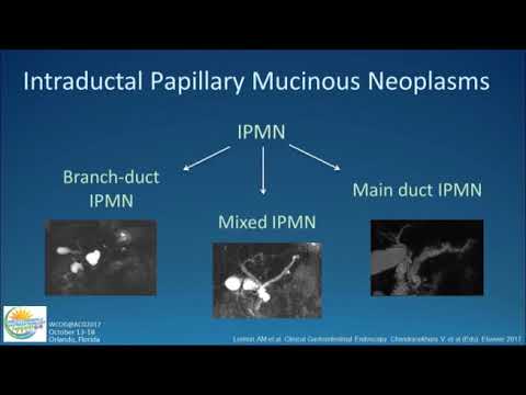 Approach to Cystic Lesions of the Pancreas