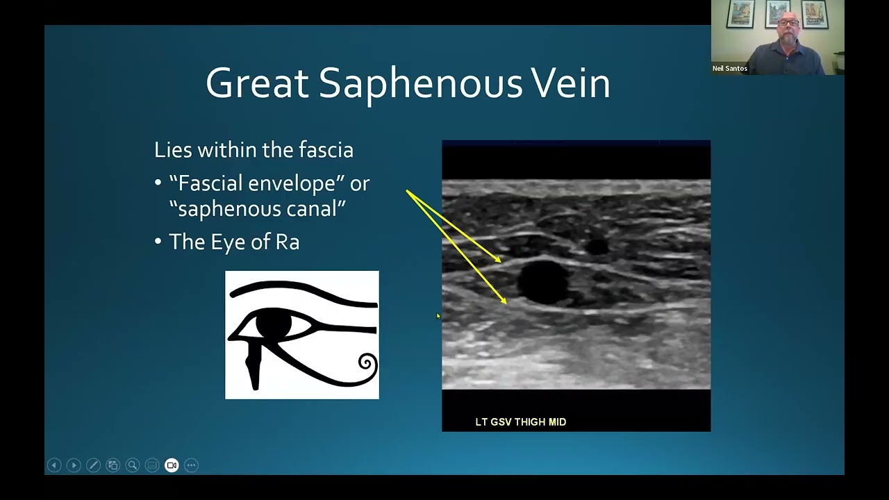 Vascular Imaging Webinar Series: DVT And Venous Insufficiency