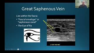 Vascular Imaging Webinar Series: DVT And Venous Insufficiency