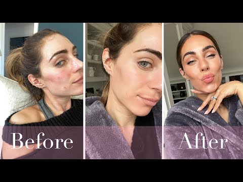 WHAT I'VE HAD DONE | Lydia Elise Millen