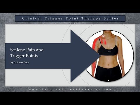Scalene Pain and Trigger Points