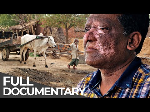 Extreme India: Cow Vigilantes, Disabled Dating & More