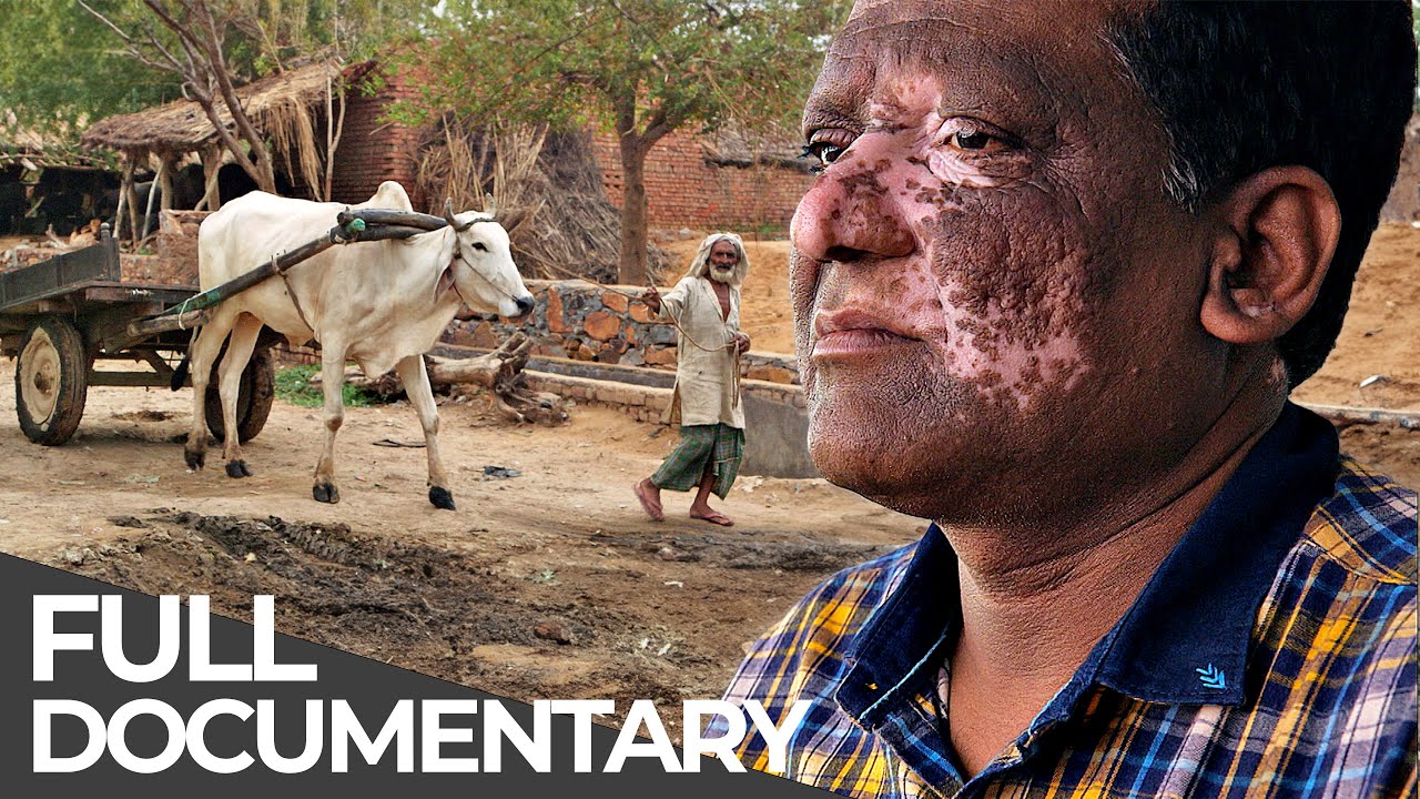 Extreme India: Cow Vigilantes, Disabled Dating & More
