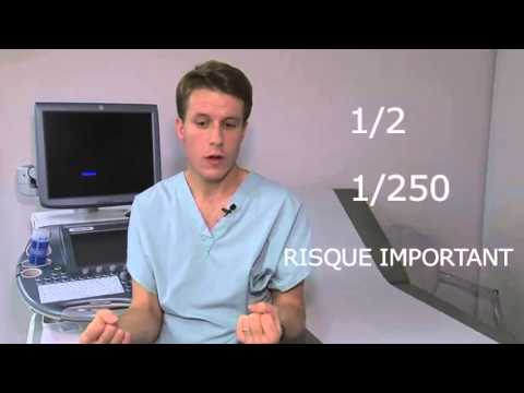 Le dépistage de la trisomie 21