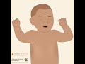 RSV: Signs & Symptoms in Babies | AAP #shorts