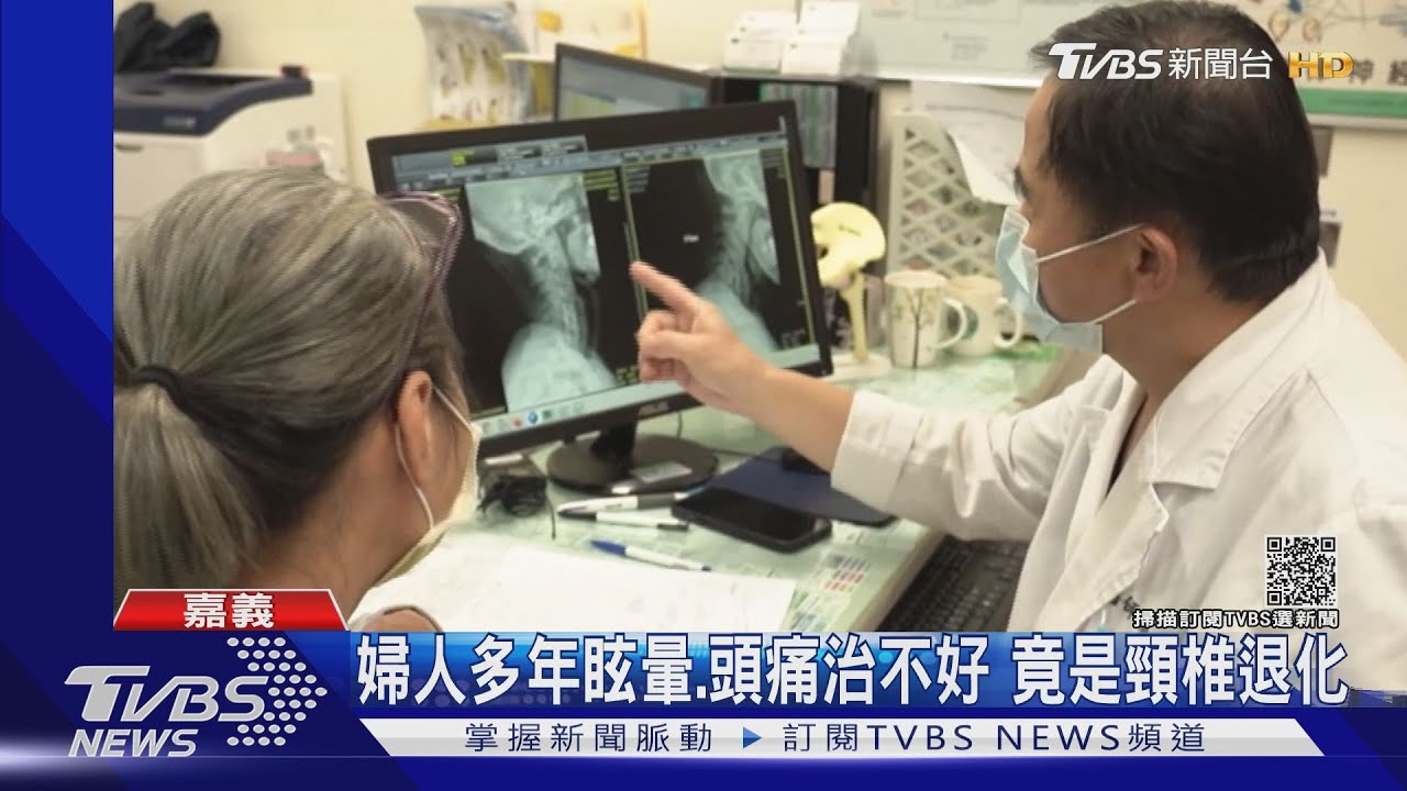 婦人多年眩暈、頭痛治不好 竟是頸椎退化引起