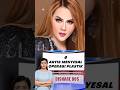 4 Artis Yang Menyesal Setelah Operasi Plastik Shorts Artis Oplas