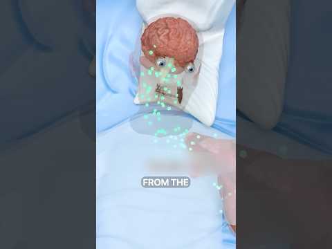 What is Phantom Pain 😱 Surgeon Reacts